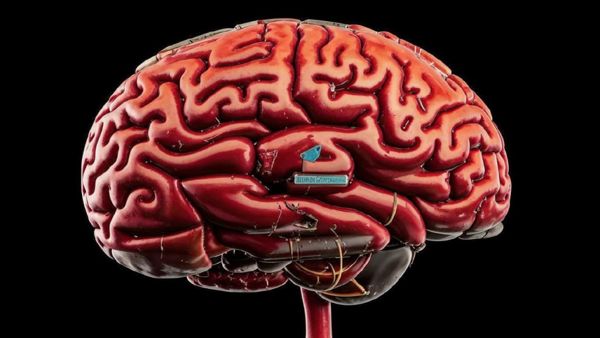 Нейросеть научили распознавать хронические гематомы головного мозга по КТ-снимкам 1-1.jpg (jpg, 40 Kб)